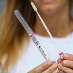 Swab vaginal microbioma