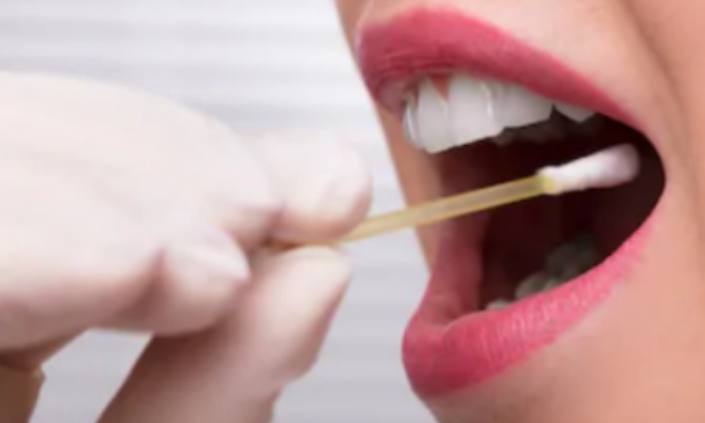 transport of saliva samples